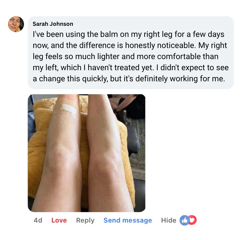Mirundo Miracle Leg Balm benefits