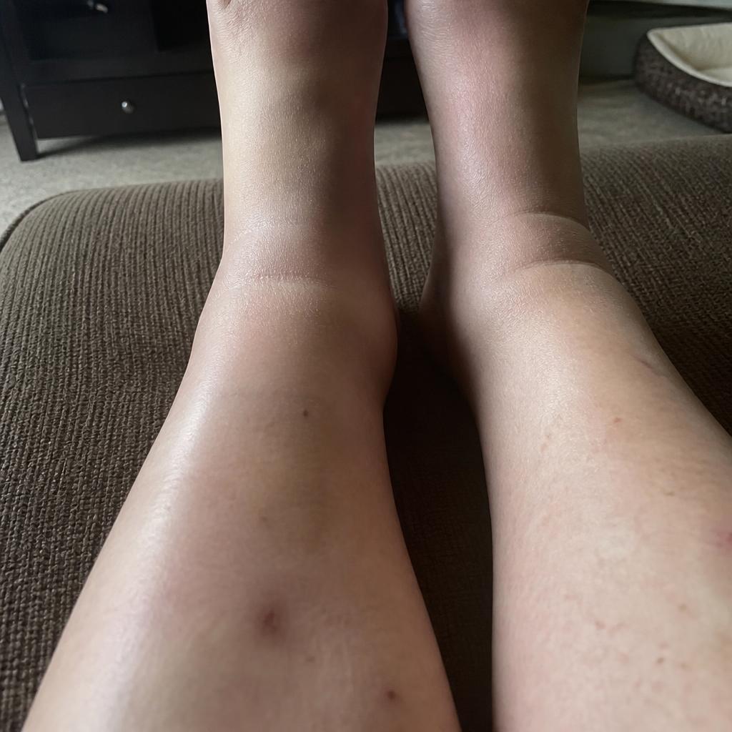 Ankle Pain detail